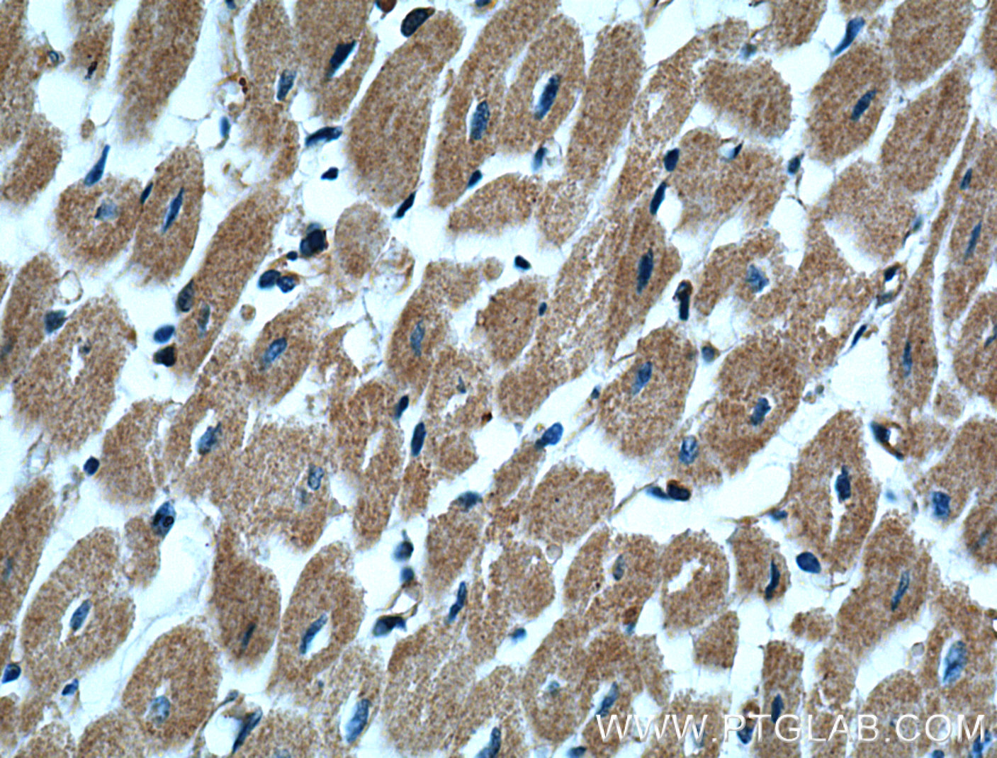 Alpha Actinin Polyclonal antibody