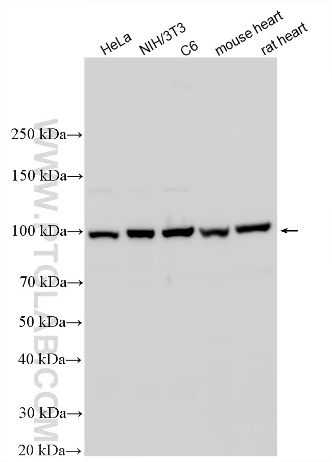 Various lysates were subjected to SDS PAGE followed by western blot with 11313-2-AP (Alpha Actinin antibody) at dilution of 1:20000 incubated at room temperature for 1.5 hours. WB analysis using 11313-2-AP