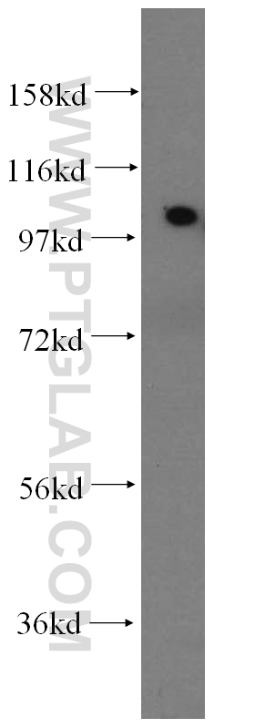 ACTN2 Polyclonal antibody
