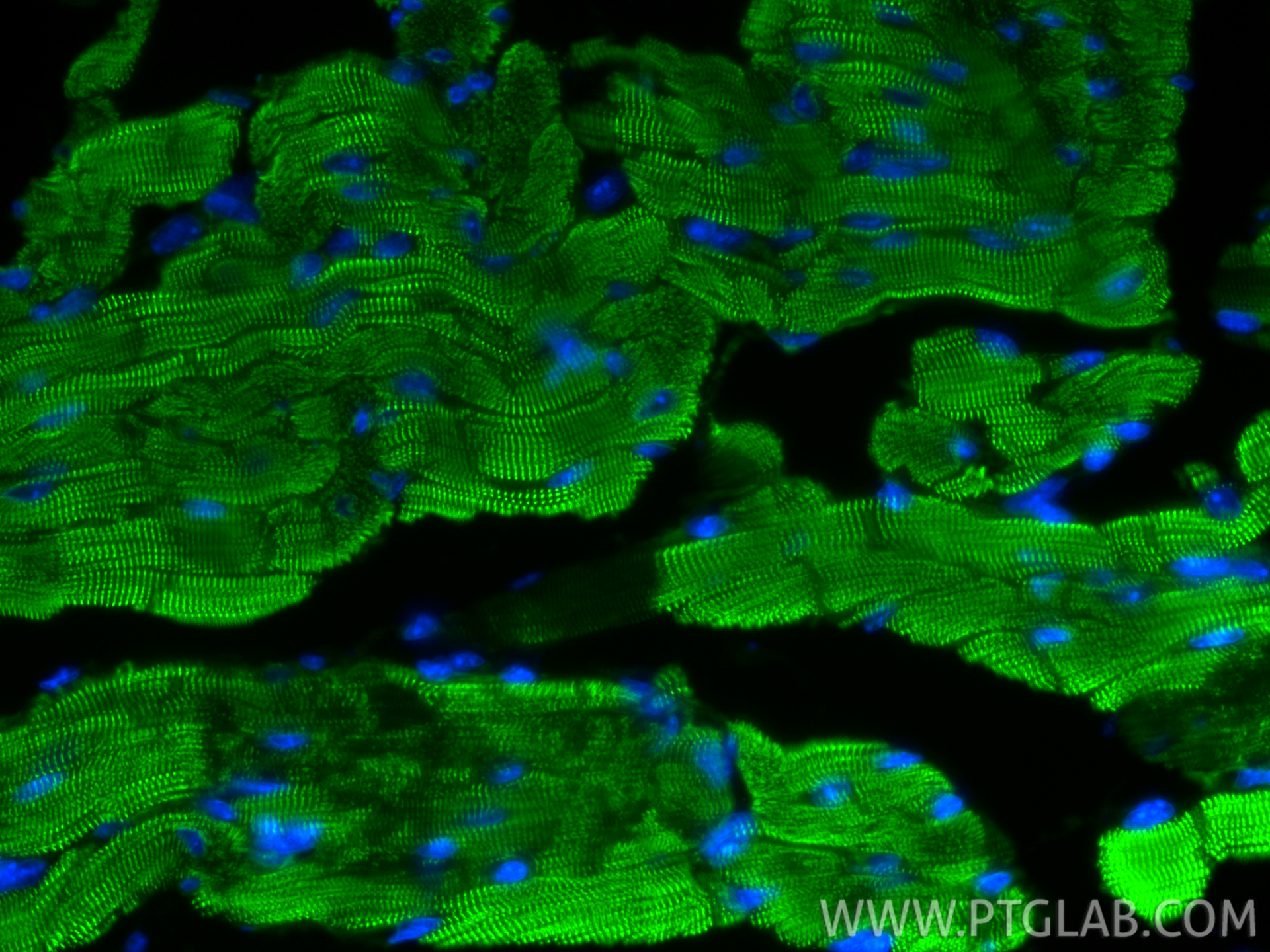 IF Staining of mouse heart using 85857-4-RR IF Staining of mouse heart using 85857-4-RR