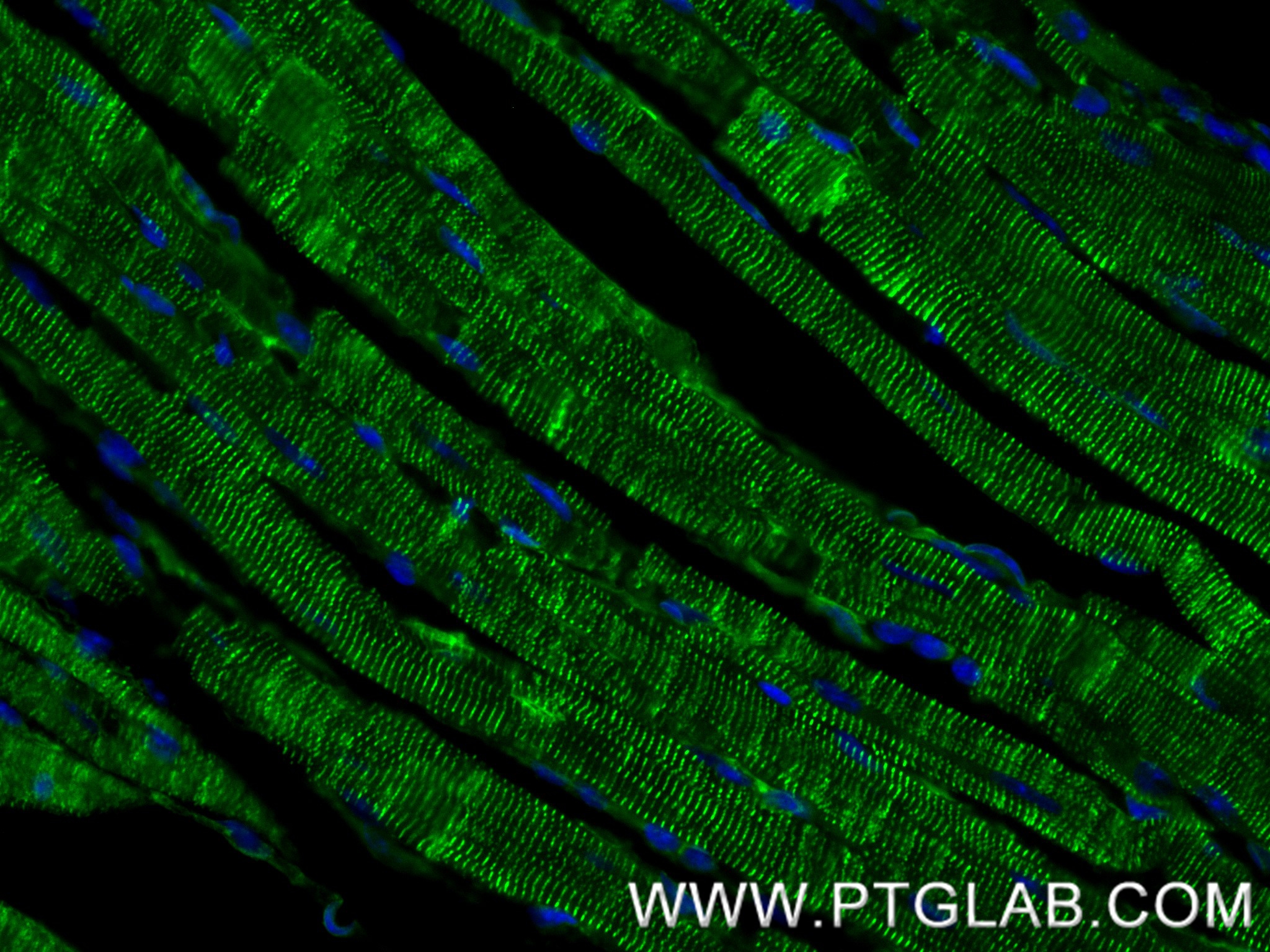 IF Staining of mouse heart using 85857-4-RR IF Staining of mouse heart using 85857-4-RR
