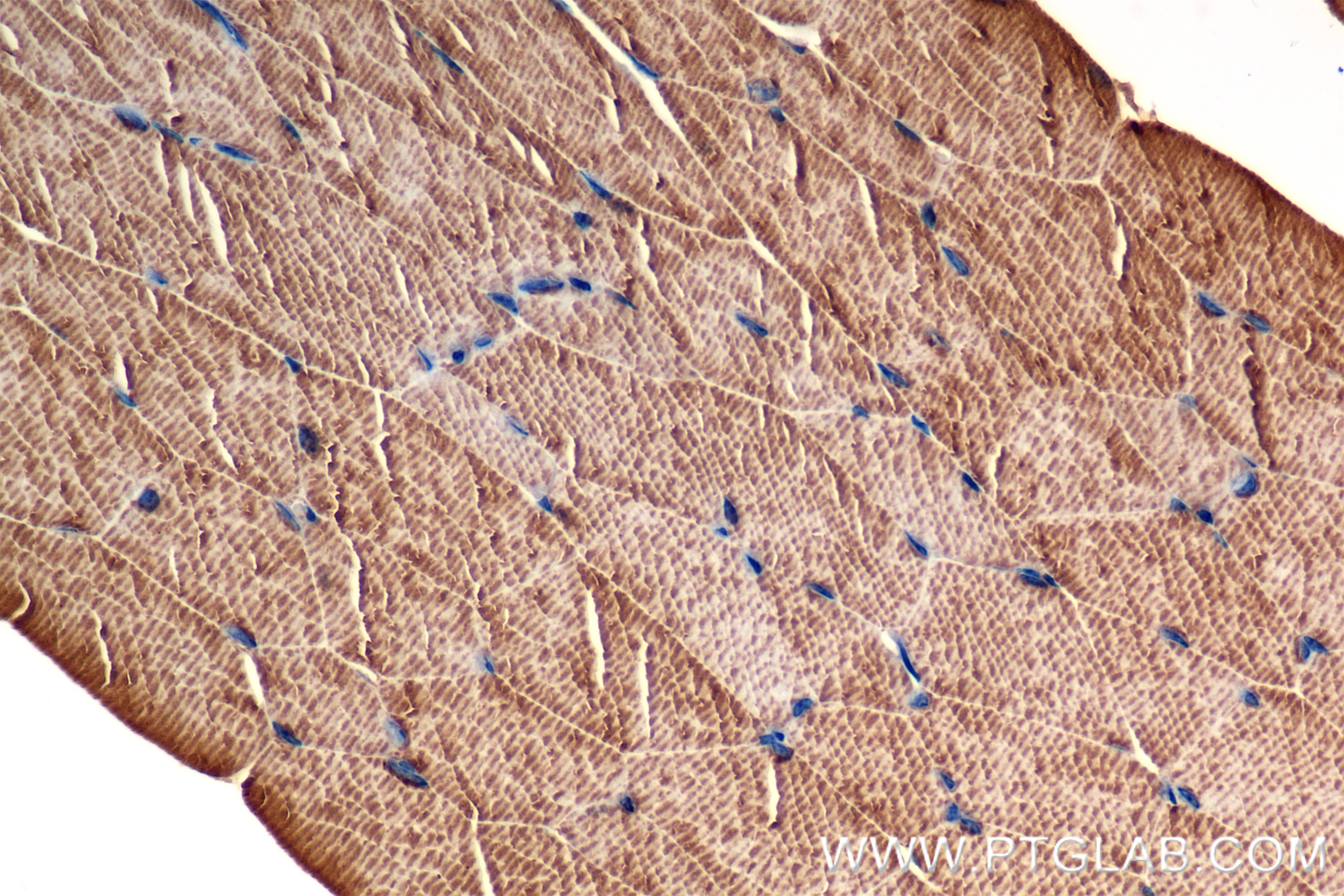 IHC staining of mouse skeletal muscle using 85857-4-RR (same clone as 85857-4-PBS)
