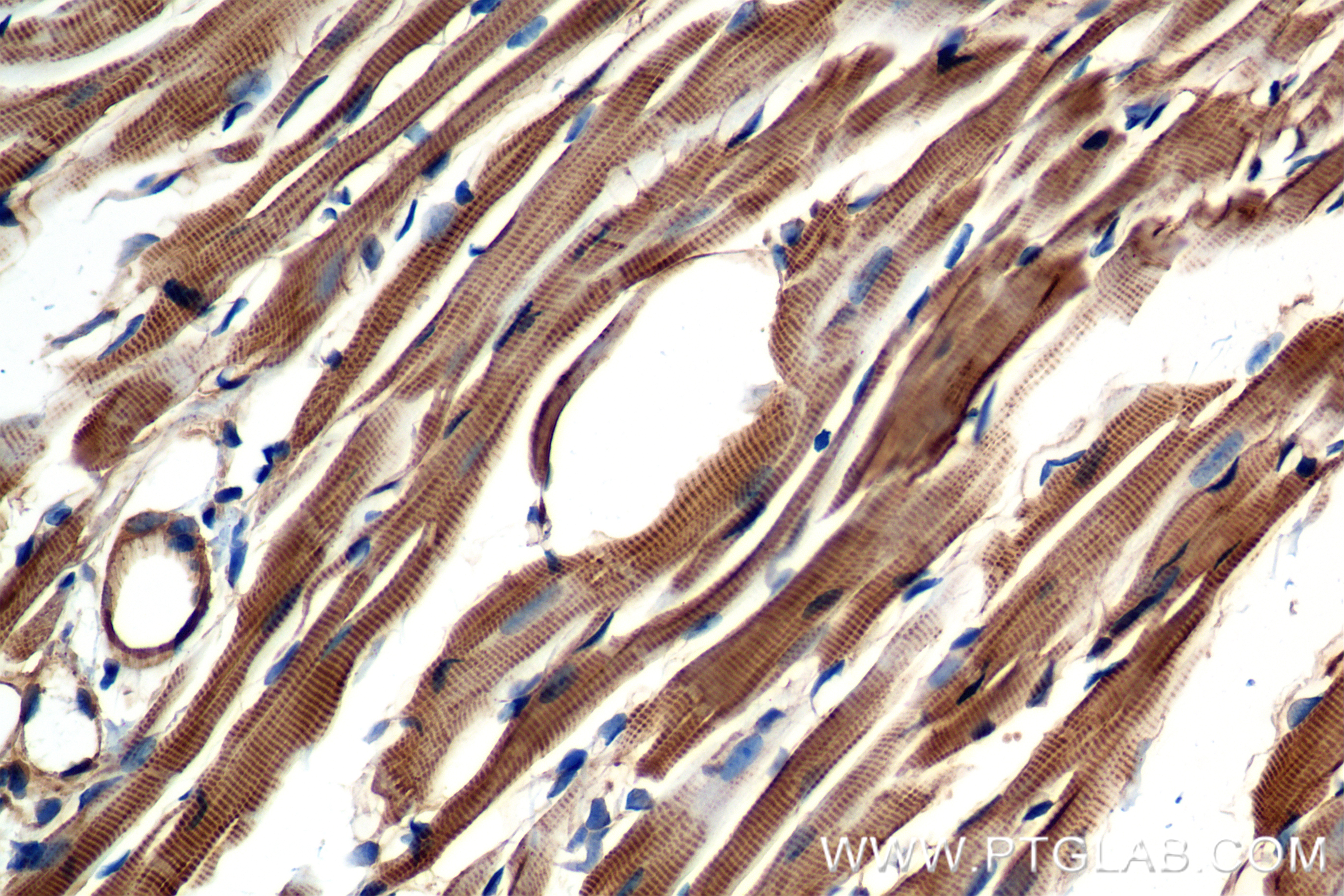 IHC staining of mouse heart using 85857-4-RR (same clone as 85857-4-PBS)