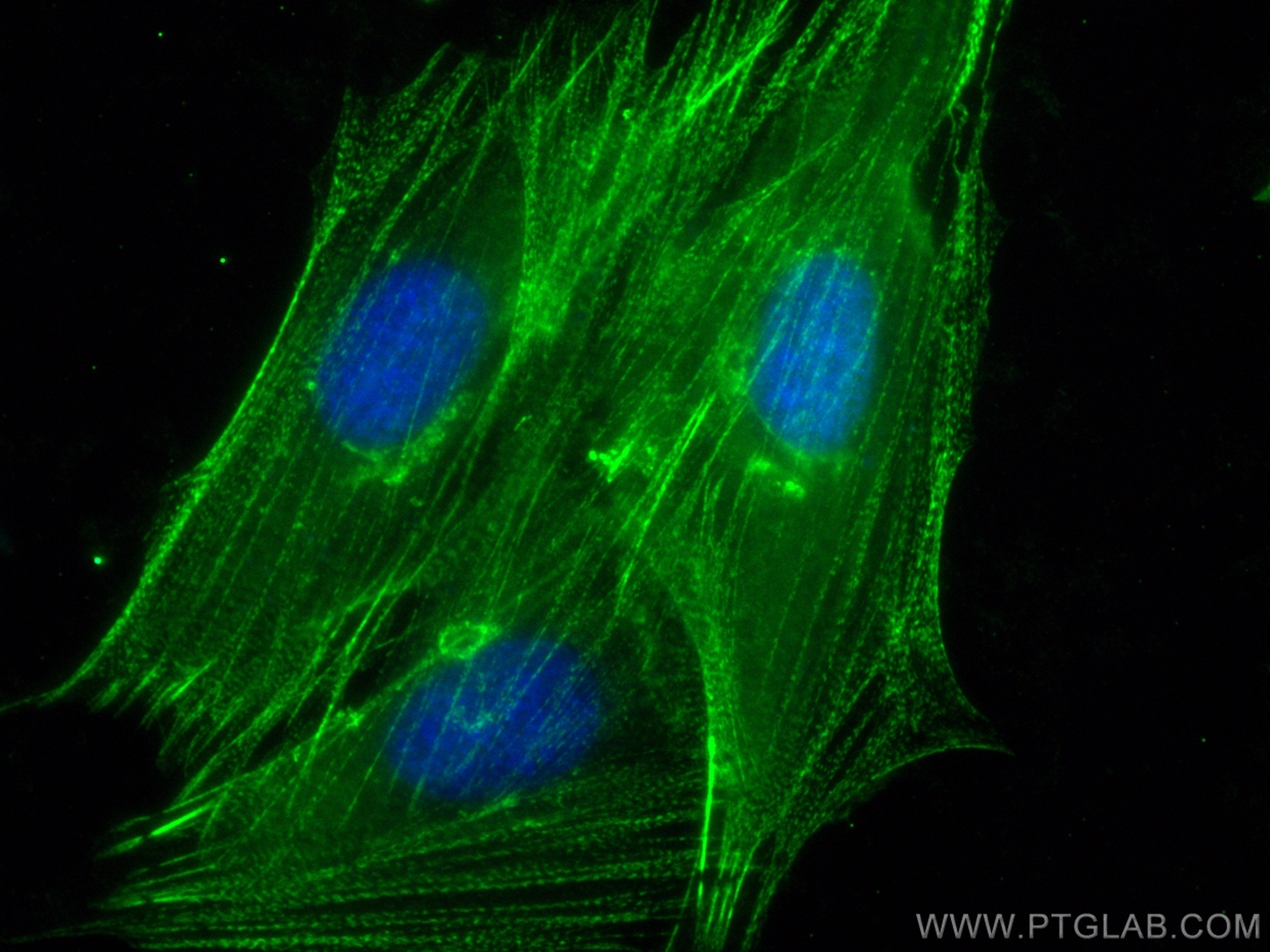 IF Staining of H9C2 using CL488-14221