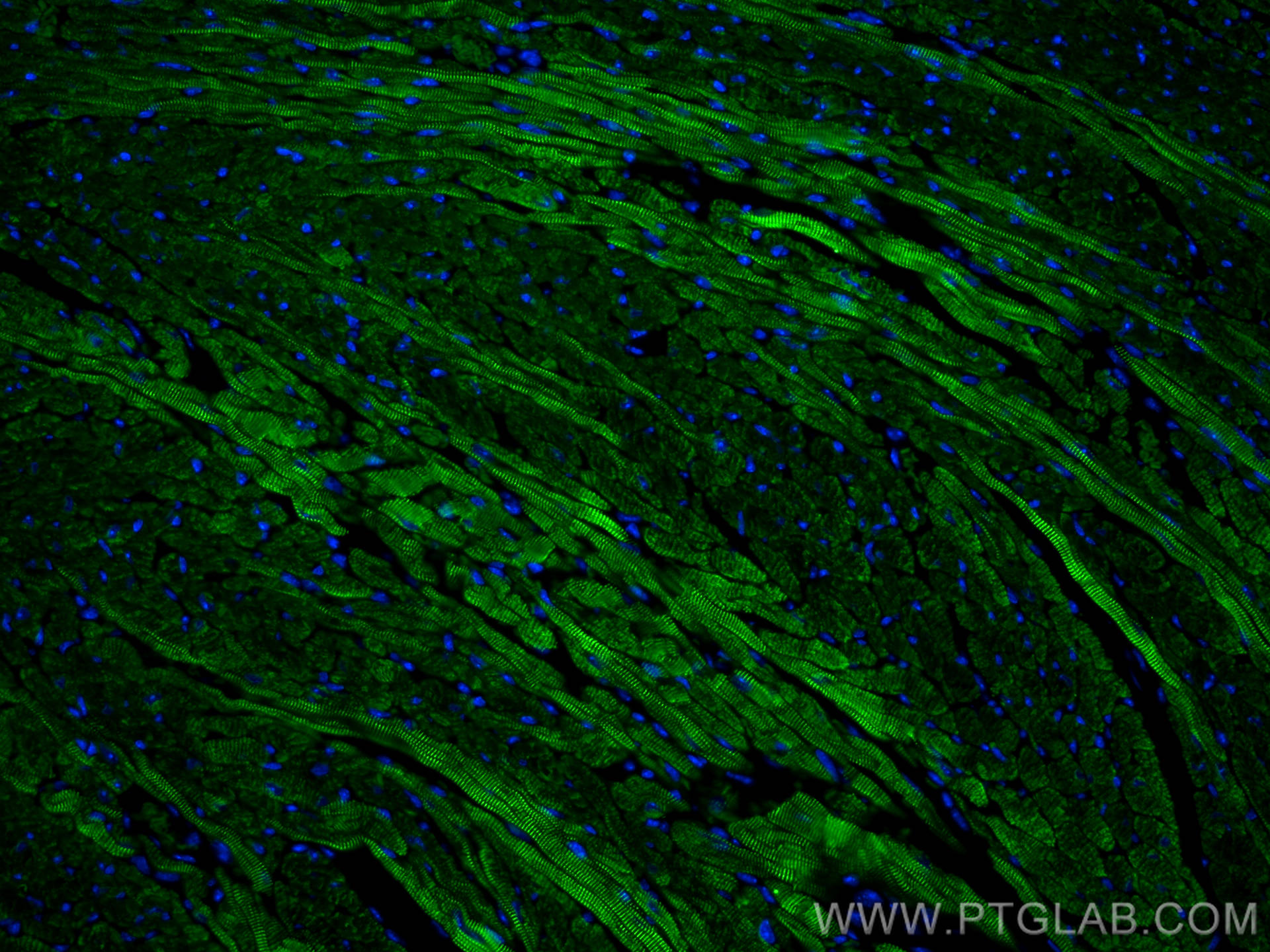 IF Staining of mouse heart using CL488-14221