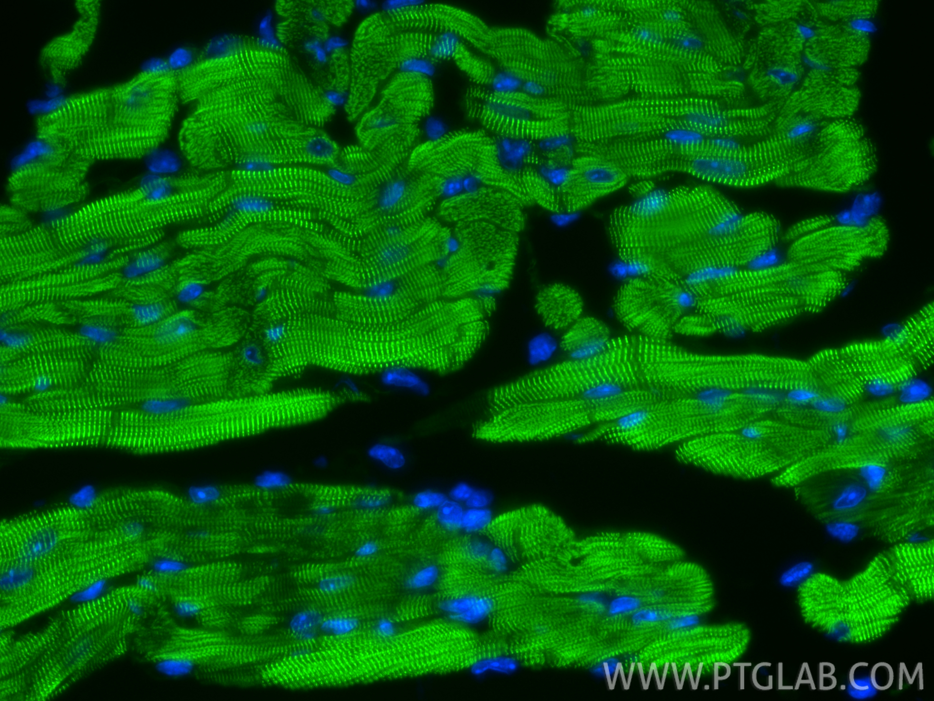 IF Staining of mouse heart using CL488-85857-4