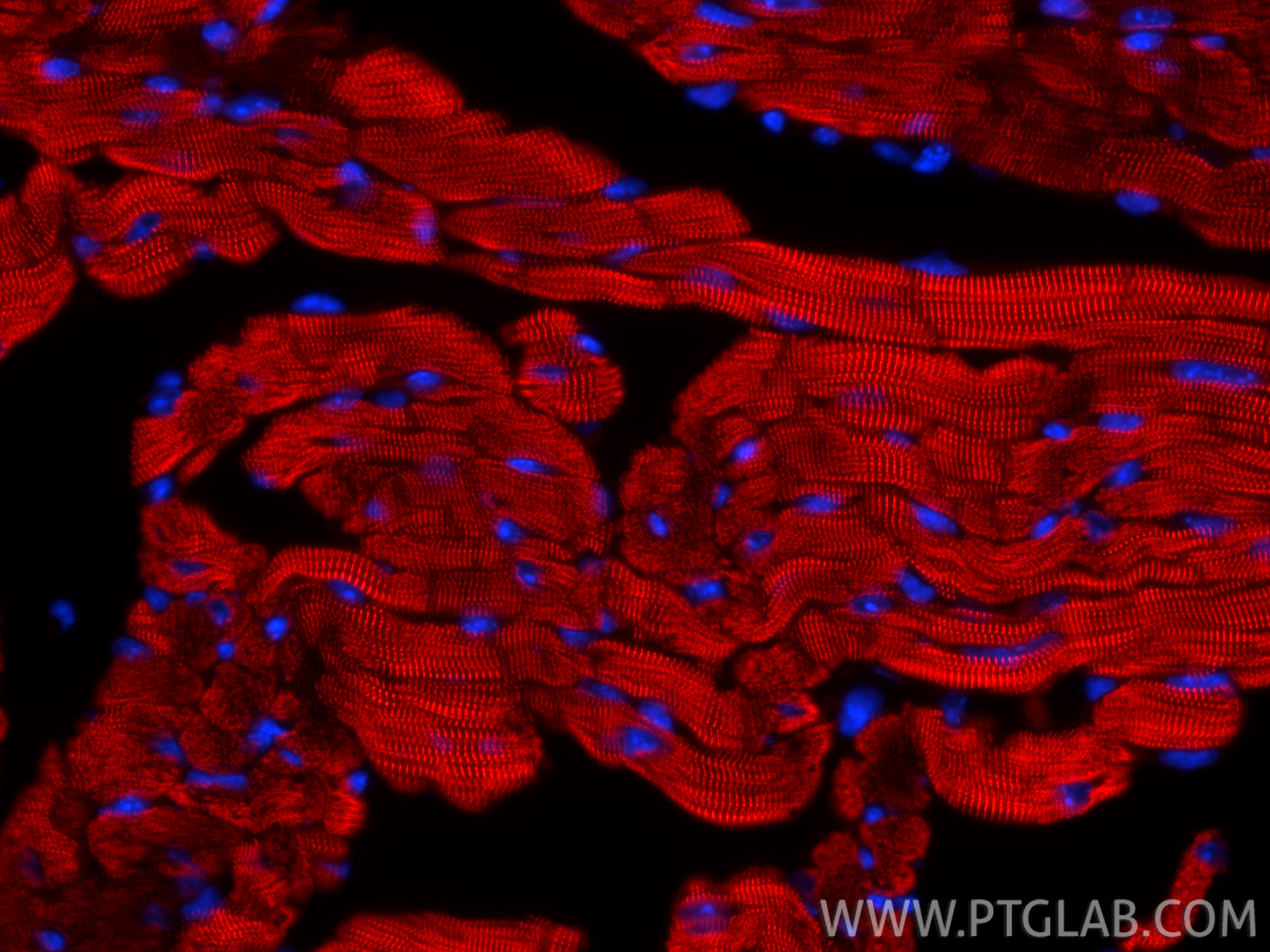 IF Staining of mouse heart using CL594-85857-4 IF Staining of mouse heart using CL594-85857-4