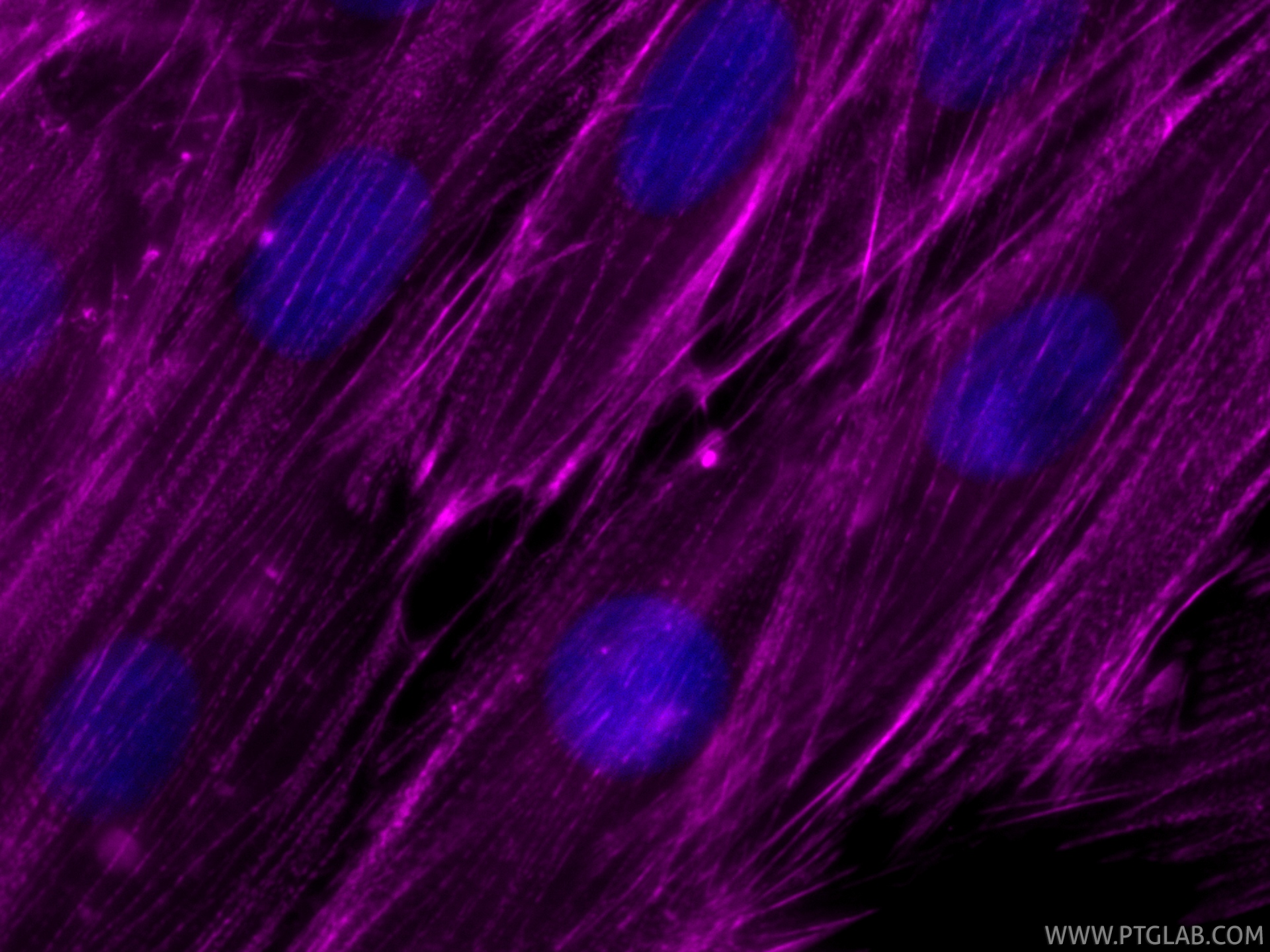 IF Staining of H9C2 using CL647-85857-4