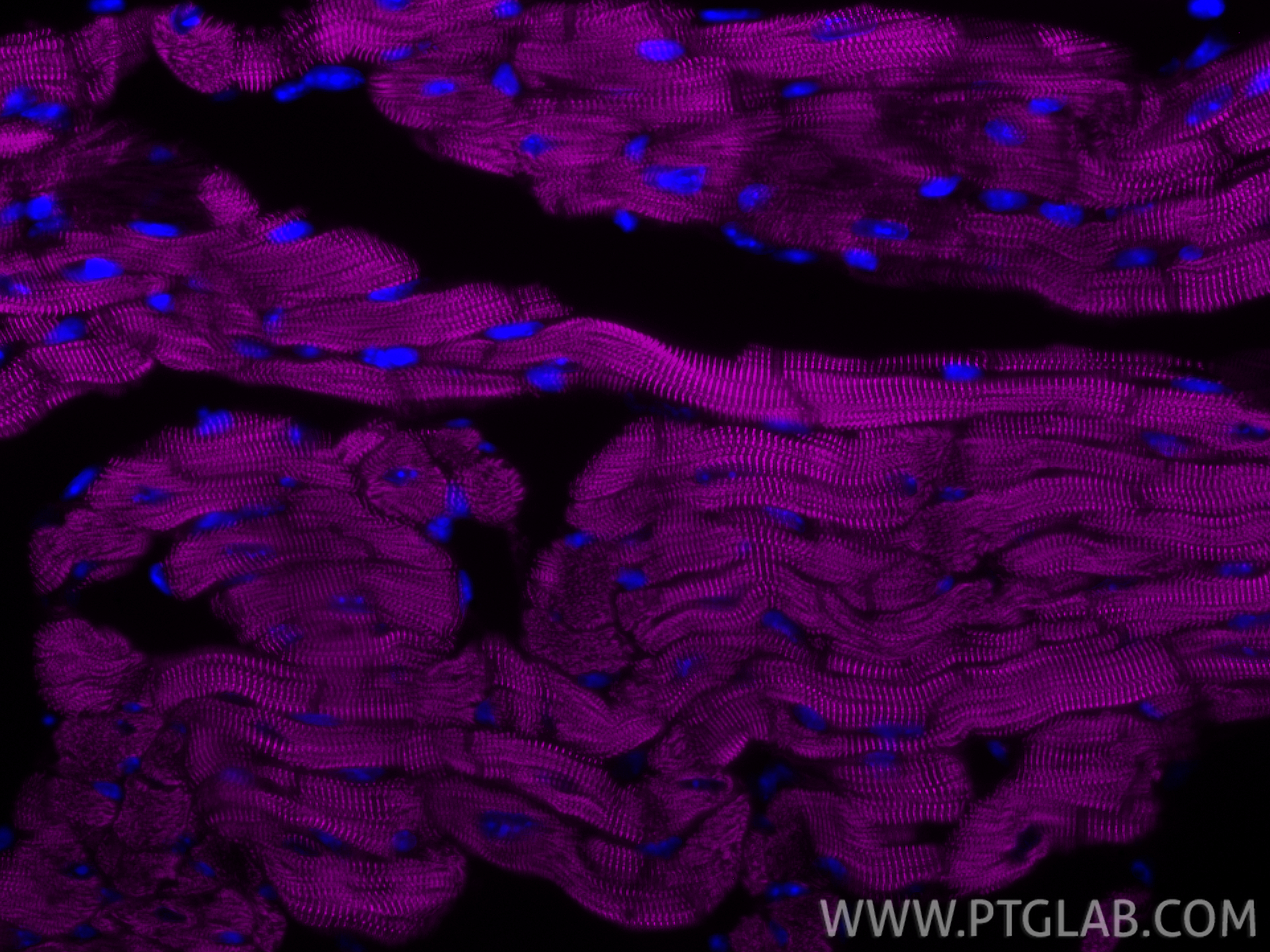 IF Staining of mouse heart using CL647-85857-4