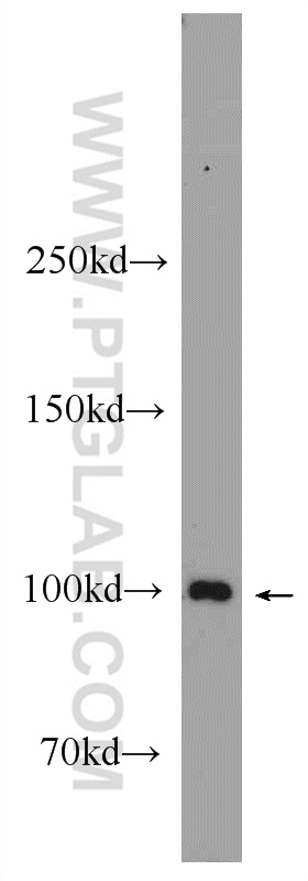 WB analysis of mouse skeletal muscle using 24378-1-AP