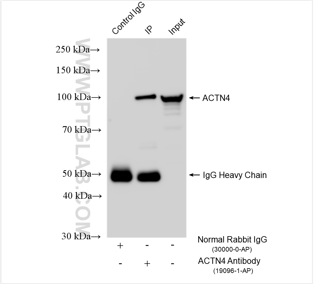 IP experiment of HeLa using 19096-1-AP
