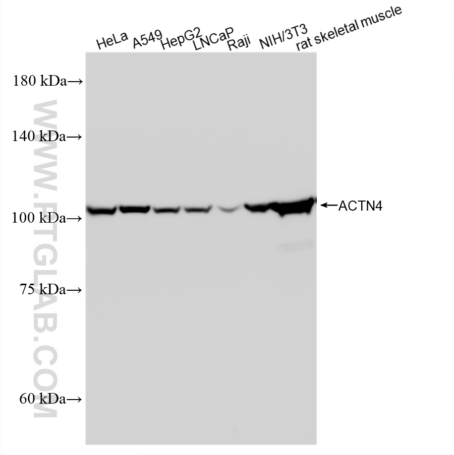 WB analysis using 87922-1-RR (same clone as 87922-1-PBS) WB analysis using 87922-1-RR (same clone as 87922-1-PBS)