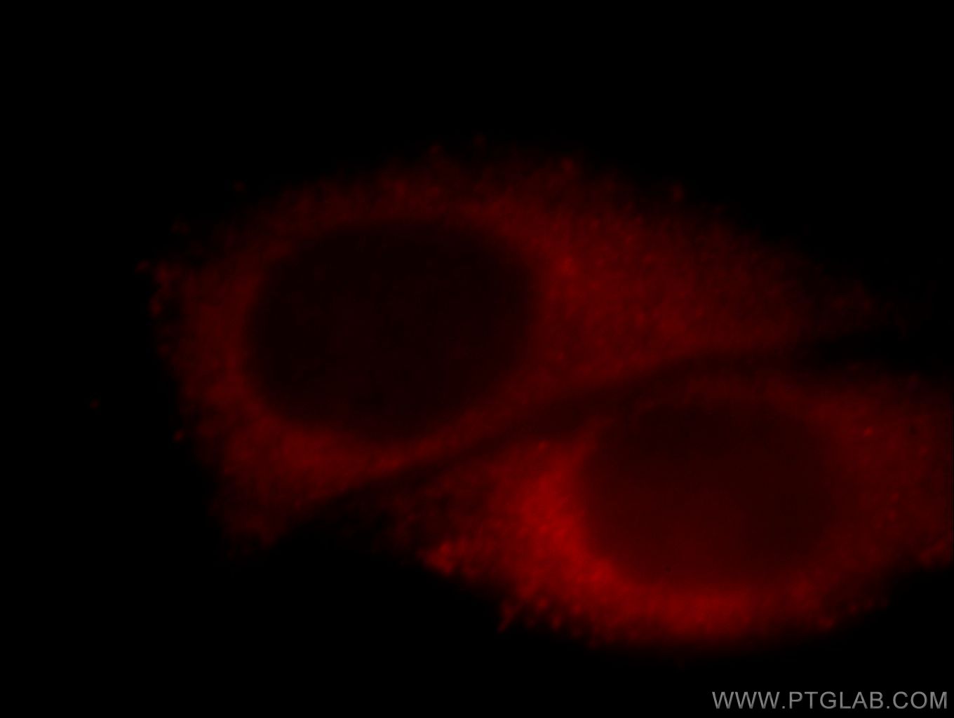 IF Staining of HepG2 using 20101-1-AP