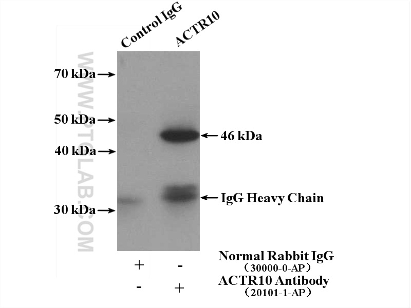 IP experiment of mouse brain using 20101-1-AP (same clone as 20101-1-PBS)