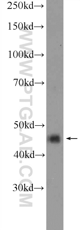 WB analysis of mouse brain using 20101-1-AP (same clone as 20101-1-PBS)