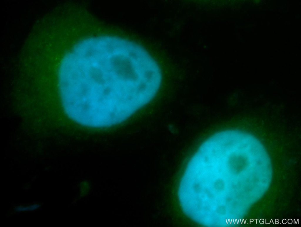 IF Staining of MCF-7 using 11023-1-AP