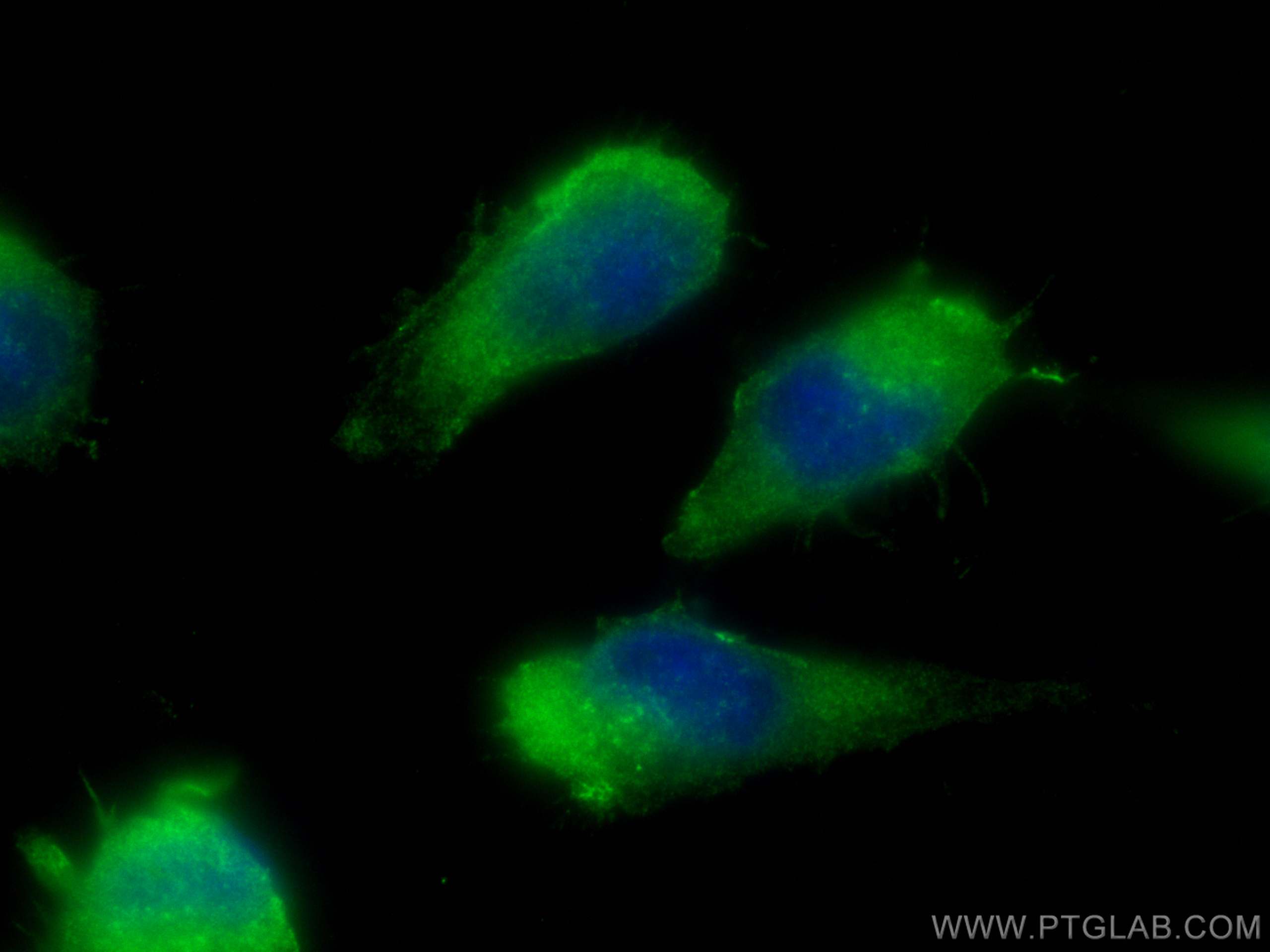 IF Staining of U-251 using 10922-1-AP