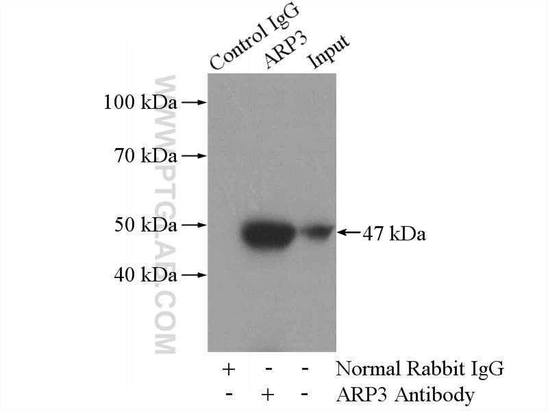 IP experiment of mouse spleen using 13822-1-AP