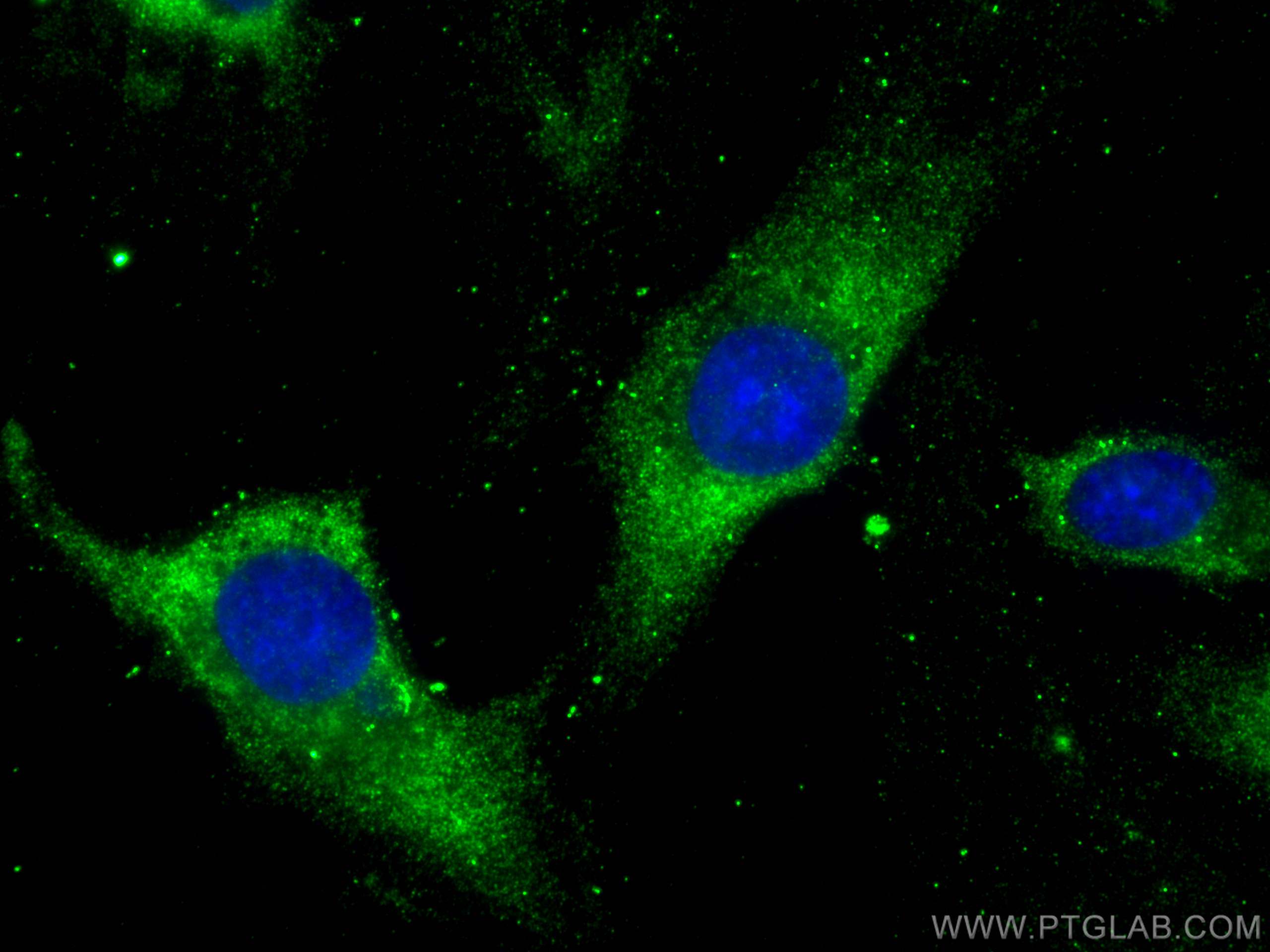 IF Staining of HUVEC using 68439-1-Ig (same clone as 68439-1-PBS)
