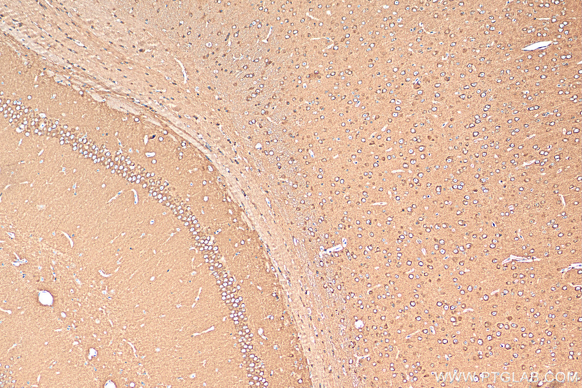IHC staining of mouse brain using 68439-1-Ig (same clone as 68439-1-PBS)