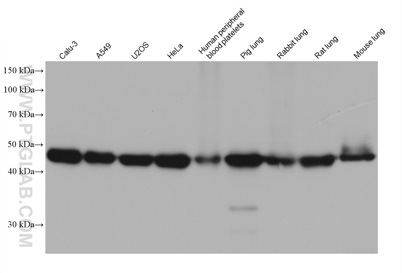 WB analysis using 68439-1-Ig (same clone as 68439-1-PBS)