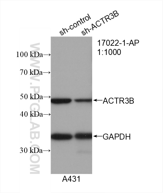 WB analysis of A431 using 17022-1-AP