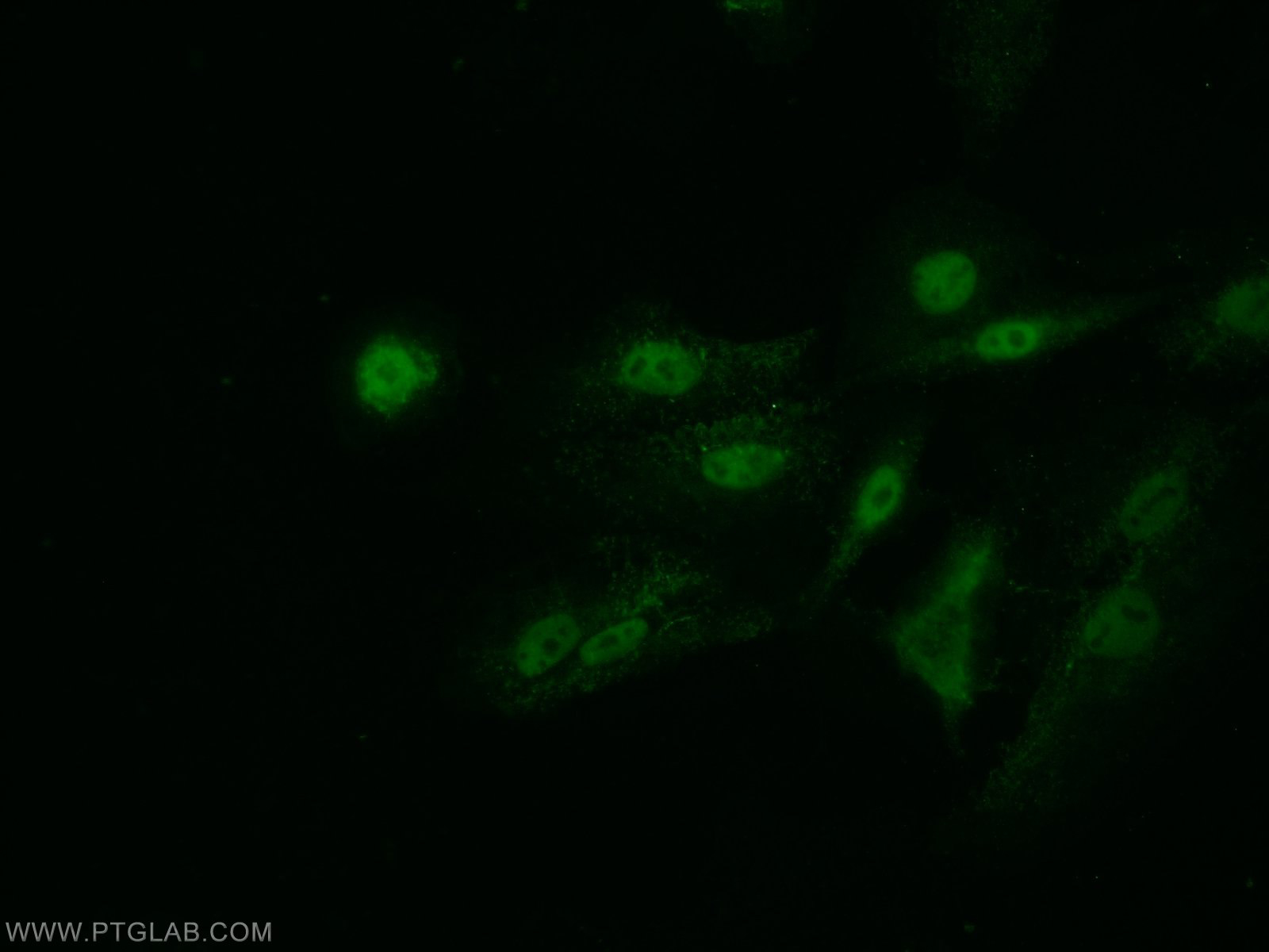 IF Staining of A549 using 21505-1-AP