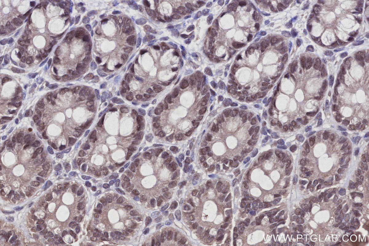 IHC staining of rat colon using 21505-1-AP IHC staining of rat colon using 21505-1-AP