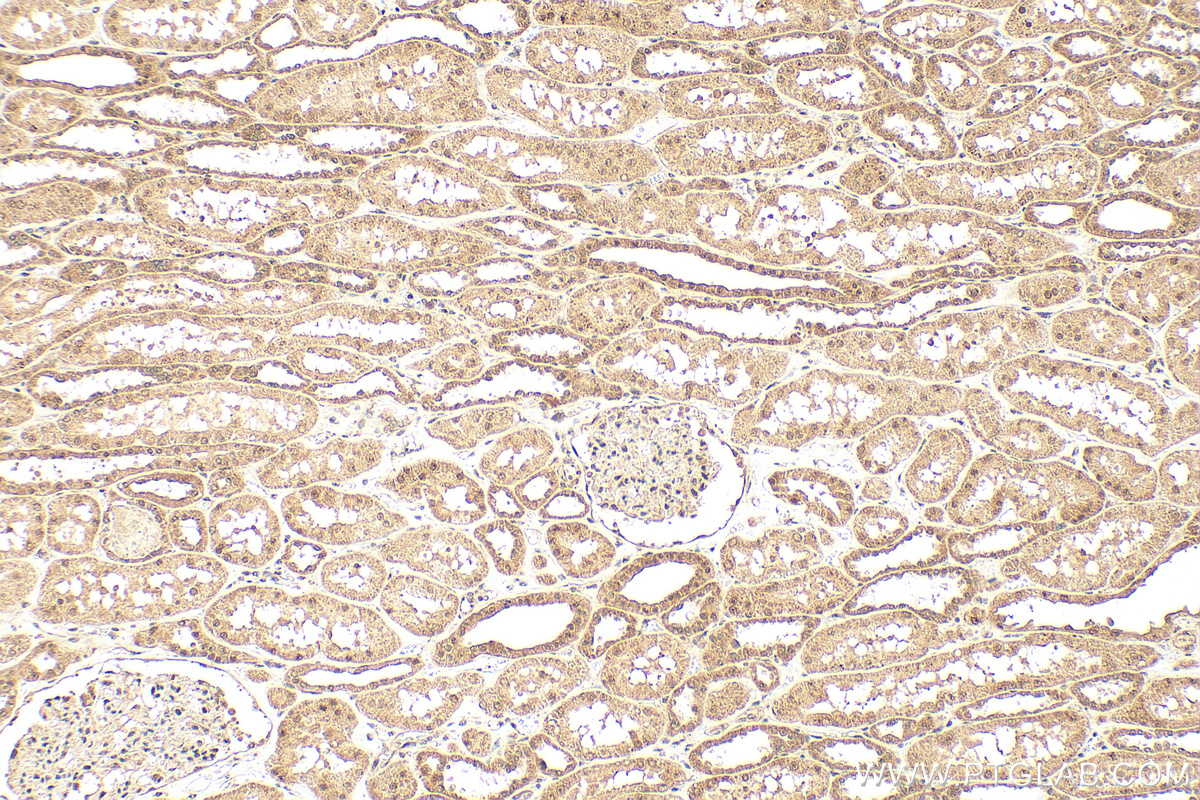 IHC staining of human kidney using 21505-1-AP (same clone as 21505-1-PBS) IHC staining of human kidney using 21505-1-AP (same clone as 21505-1-PBS)