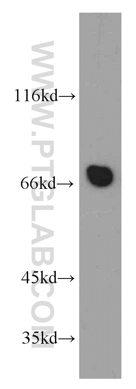 WB analysis of mouse cerebellum using 21505-1-AP