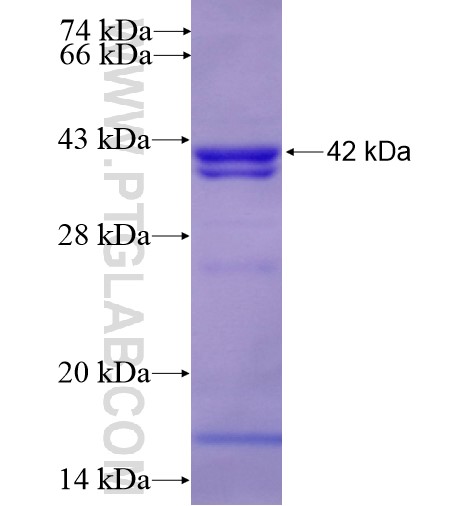 ACTR5 fusion protein Ag15976 SDS-PAGE
