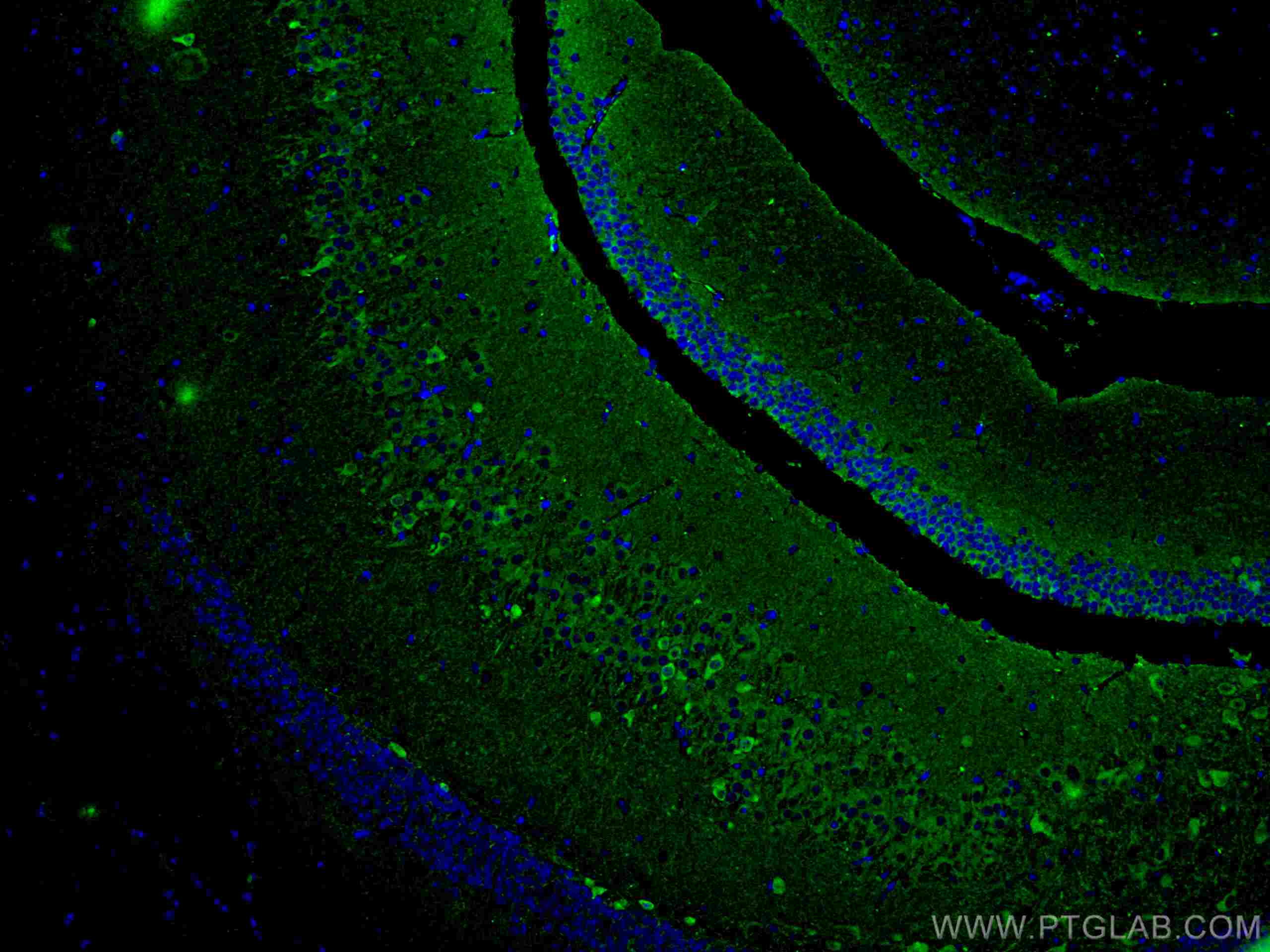 IF Staining of mouse brain using 67417-1-Ig (same clone as 67417-1-PBS)