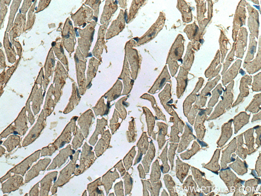 IHC staining of mouse heart using 67417-1-Ig (same clone as 67417-1-PBS)