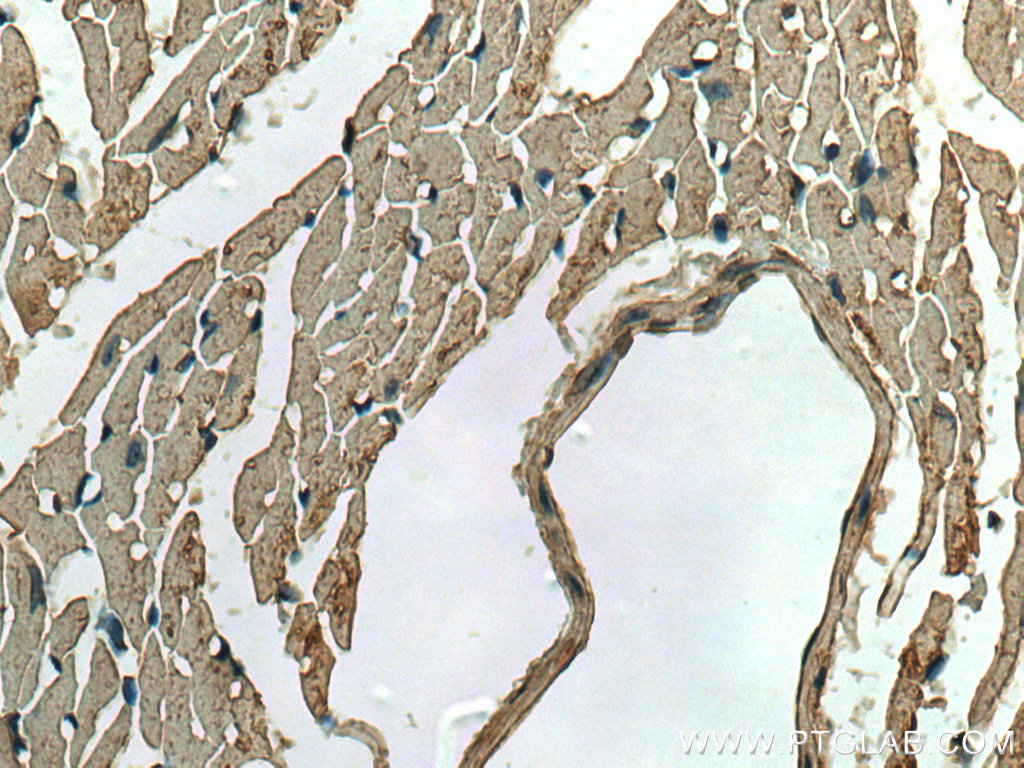 IHC staining of mouse heart using 67417-1-Ig (same clone as 67417-1-PBS)