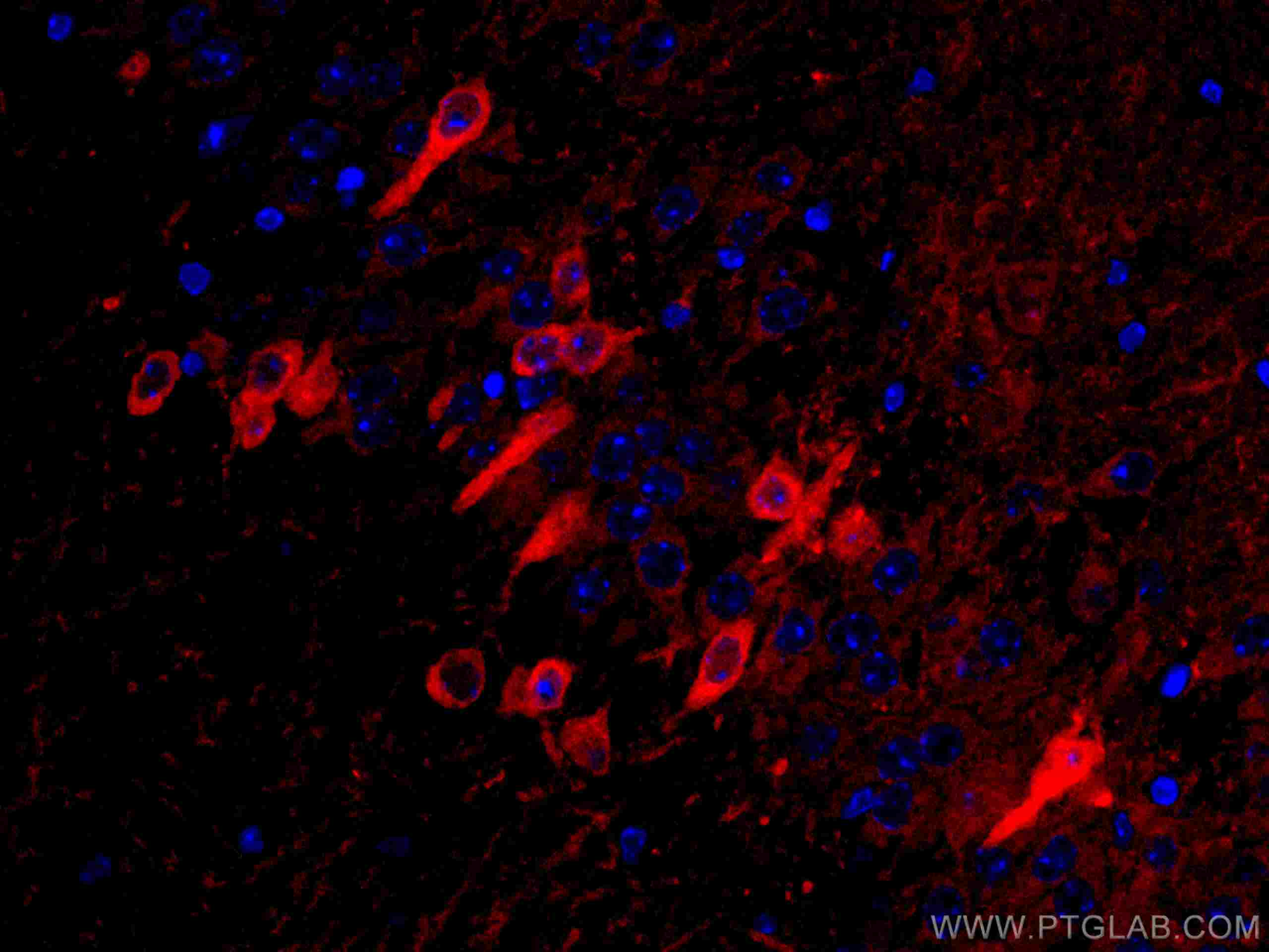 IF Staining of mouse brain using CL594-67417
