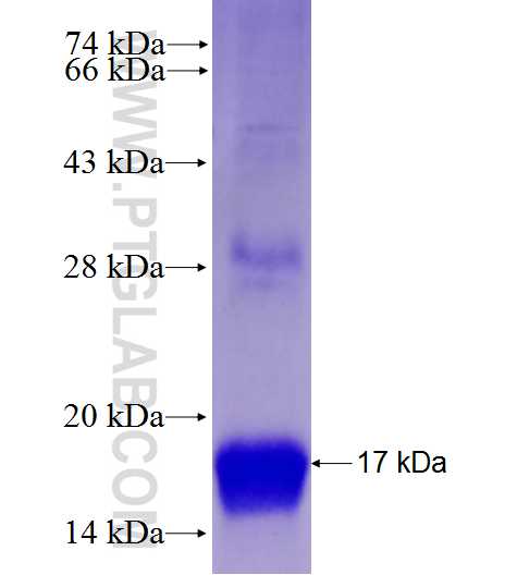 ACVR1 fusion protein Ag27954 SDS-PAGE ACVR1 fusion protein Ag27954 SDS-PAGE