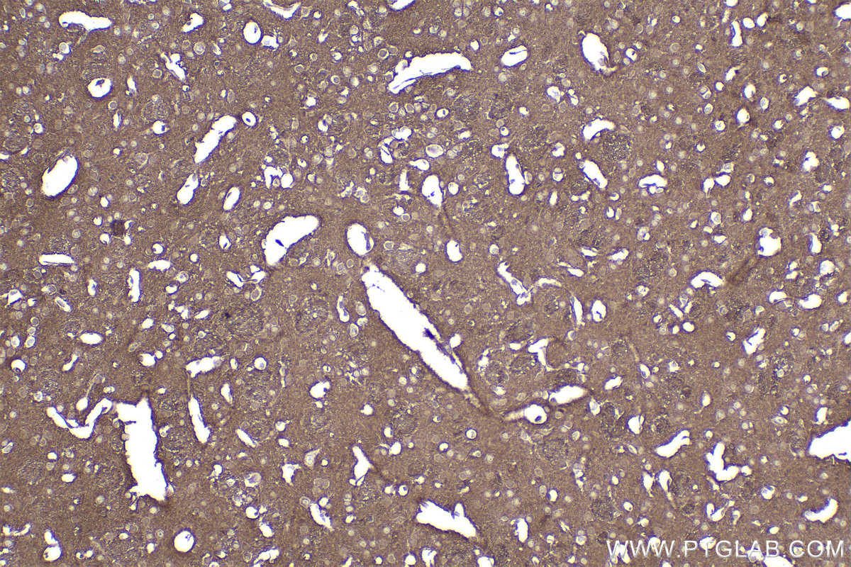 IHC staining of mouse brain using 83026-6-RR (same clone as 83026-6-PBS)