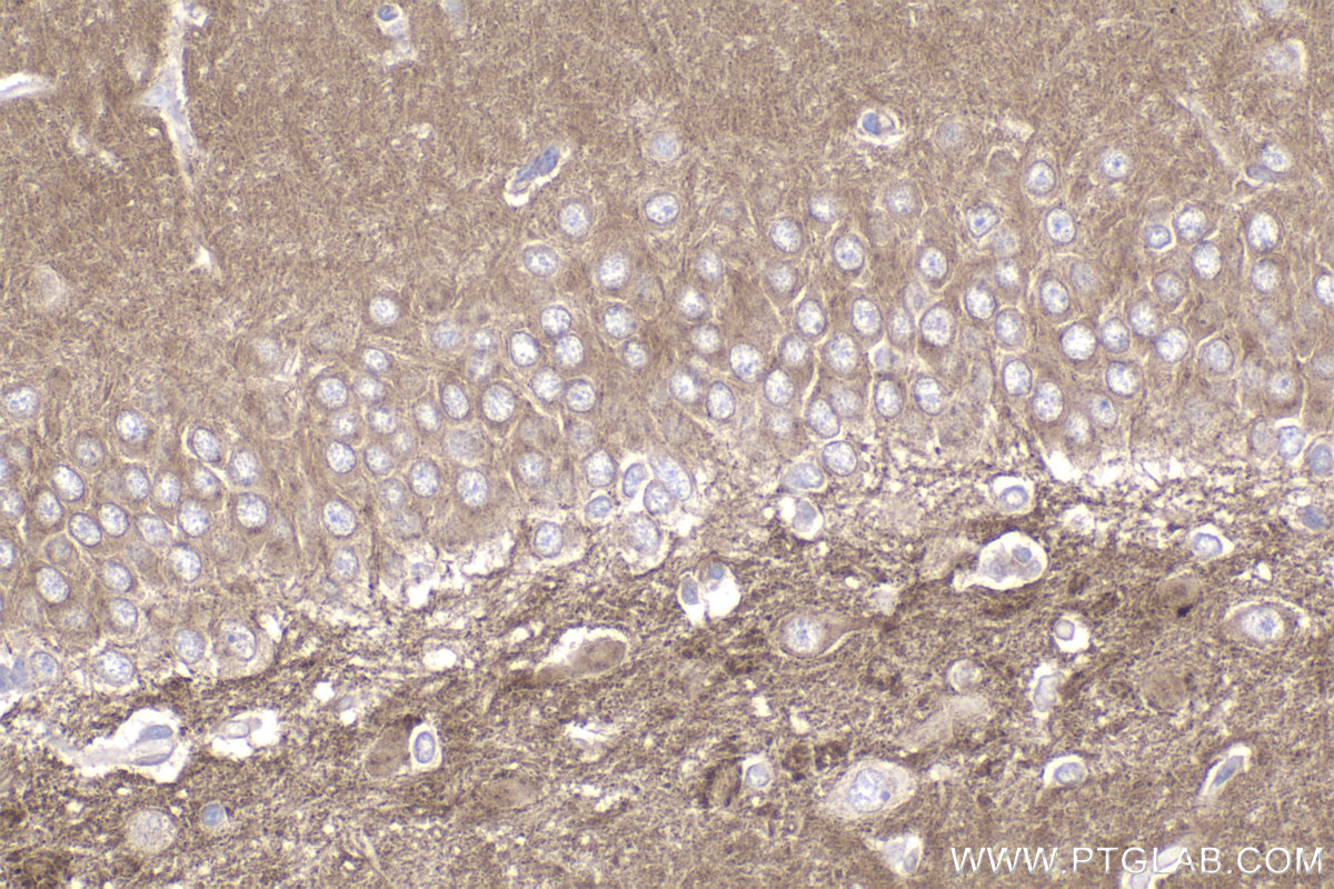 IHC staining of rat brain using 83026-6-RR (same clone as 83026-6-PBS)