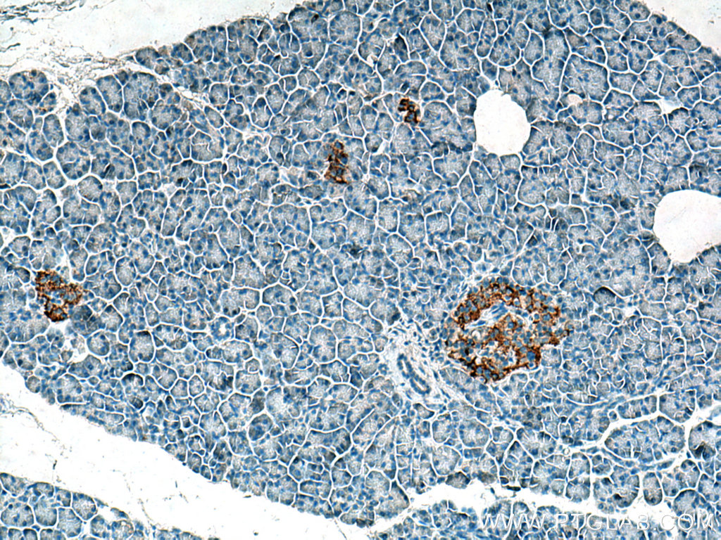 IHC staining of human pancreas using 12610-1-AP