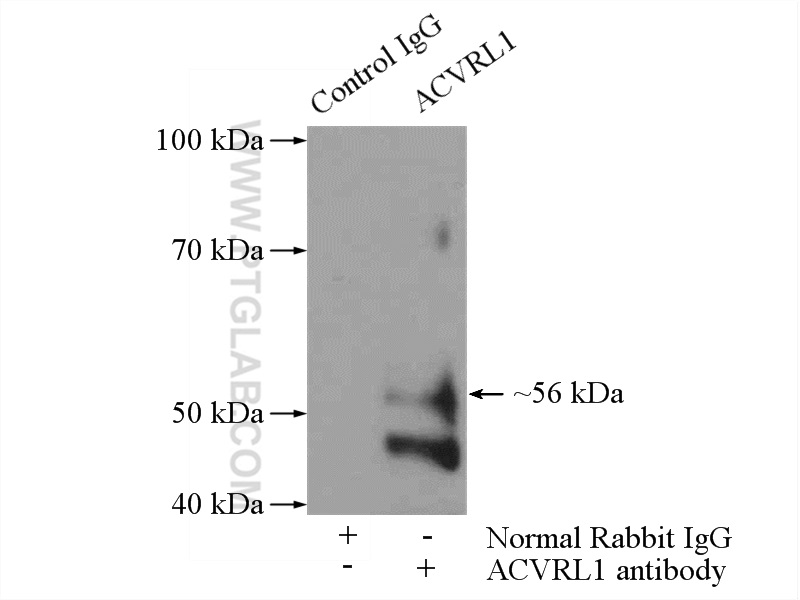 IP experiment of Jurkat using 14745-1-AP