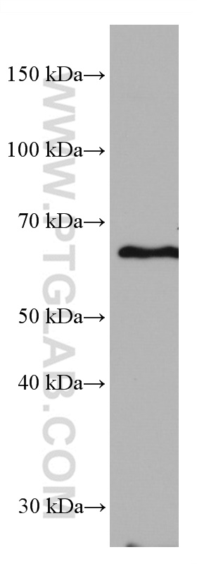 ACVRL1