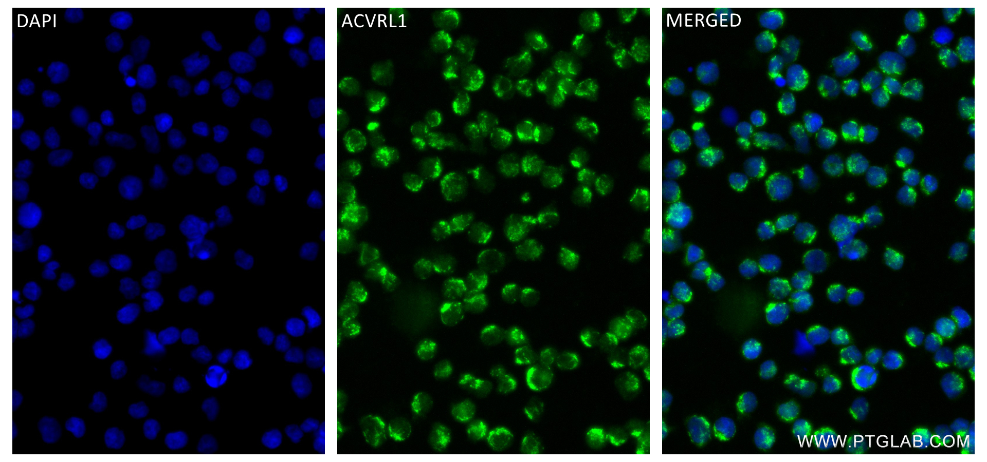 IF Staining of Jurkat using 84421-1-RR (same clone as 84421-1-PBS)