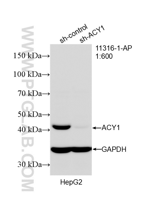 WB analysis of HepG2 using 11316-1-AP WB analysis of HepG2 using 11316-1-AP