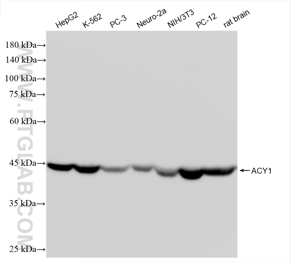 WB analysis using 86204-1-RR (same clone as 86204-1-PBS)