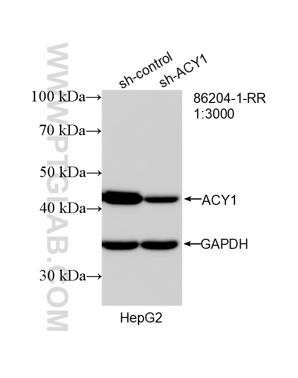 WB analysis of HepG2 using 86204-1-RR (same clone as 86204-1-PBS) WB analysis of HepG2 using 86204-1-RR (same clone as 86204-1-PBS)