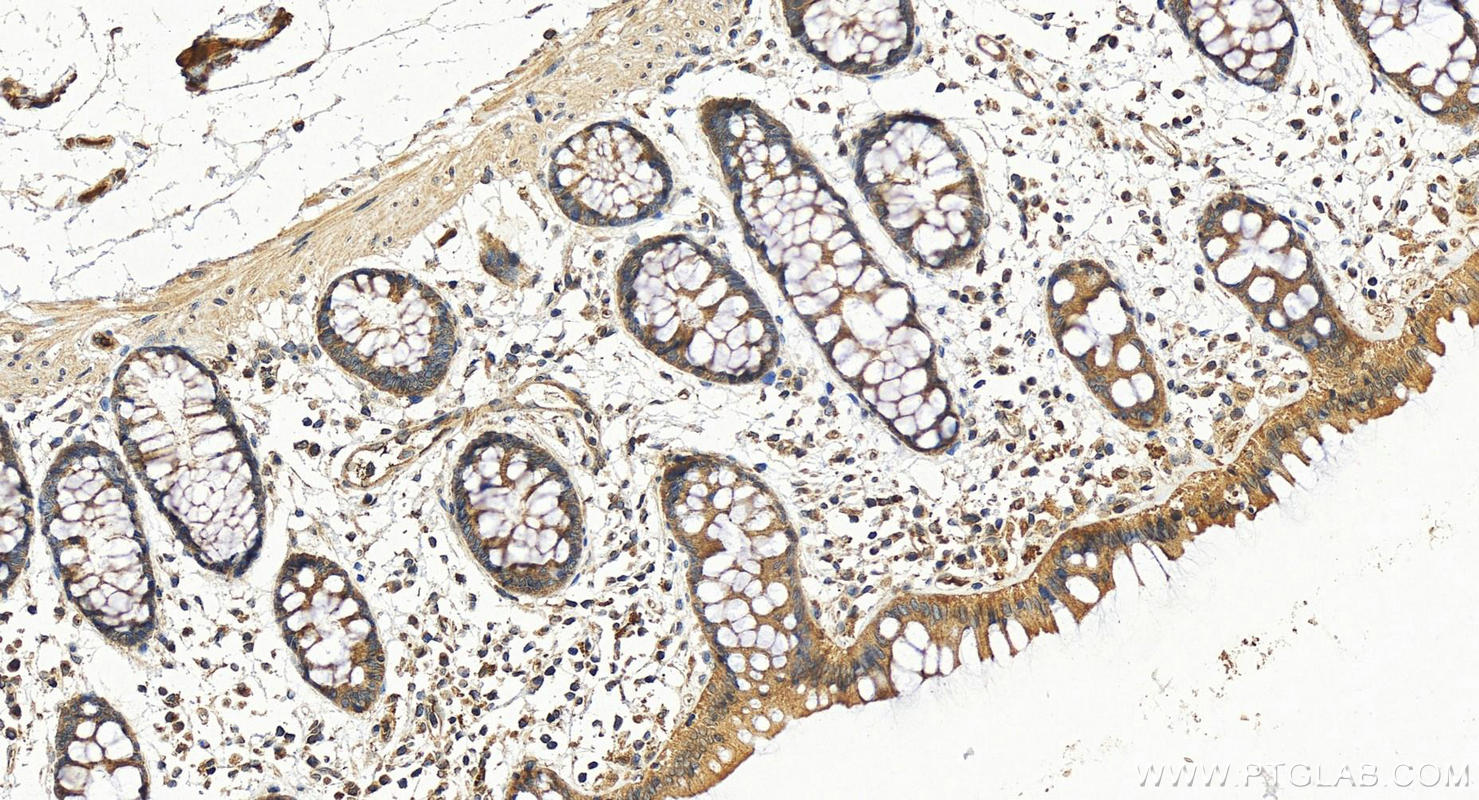 IHC staining of human colon using 16786-1-AP