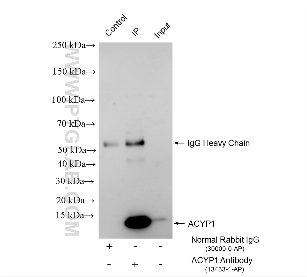 IP experiment of HEK-293 using 13433-1-AP