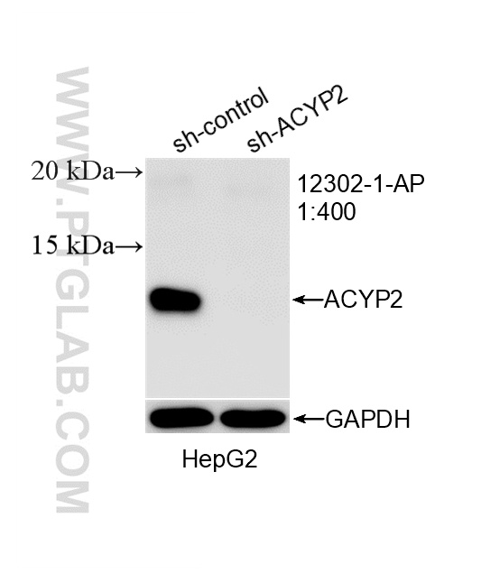 WB analysis of HepG2 using 12302-1-AP WB analysis of HepG2 using 12302-1-AP