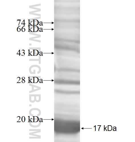 ACYP2 fusion protein Ag8288 SDS-PAGE ACYP2 fusion protein Ag8288 SDS-PAGE