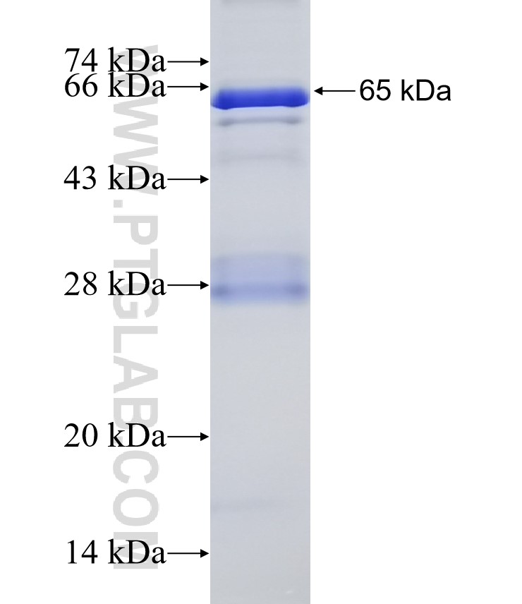 AD7c-NTP fusion protein Ag32506 SDS-PAGE AD7c-NTP fusion protein Ag32506 SDS-PAGE